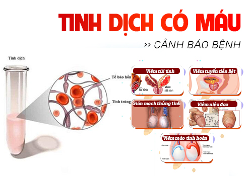 máu trong tinh dịch