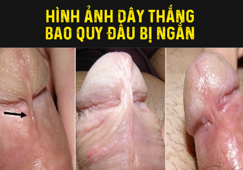 hinh-anh-day-thang-bao-quy-dau-ngan