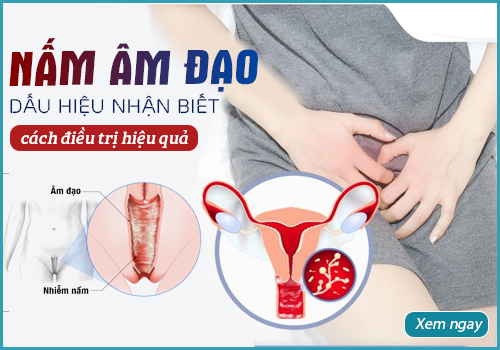 nấm âm đạo