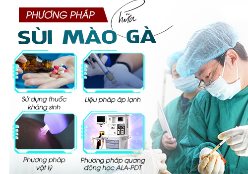 các cách chữa sùi mào gà hiện nay