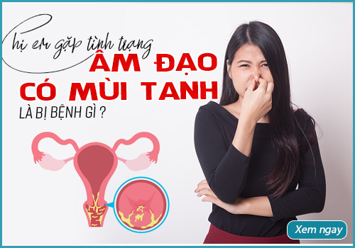 âm đạo có mùi tanh