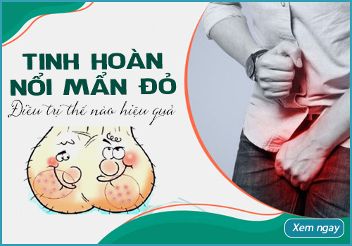 tinh hoàn nổi mẩn đỏ