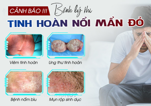 tinh hoàn nổi mẩn đỏ