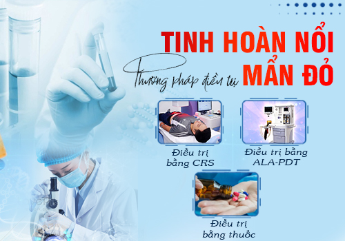 phương pháp điều trị tinh hoàn nổi mẩn đỏ