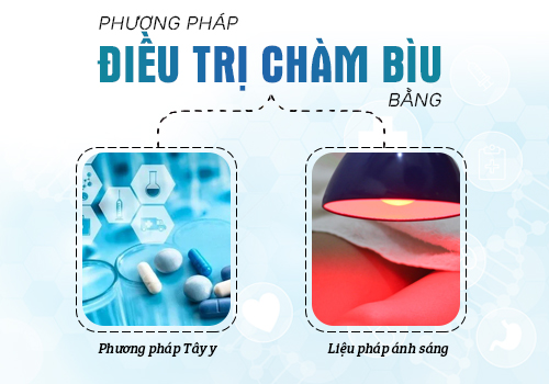 phương pháp điều trị chàm bìu