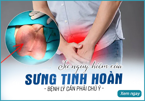 Sưng tinh hoàn