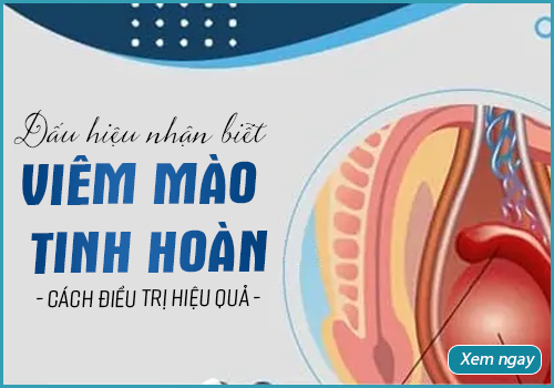 viêm mào tinh hoàn