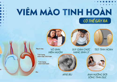 ảnh hưởng viêm mào tinh hoàn