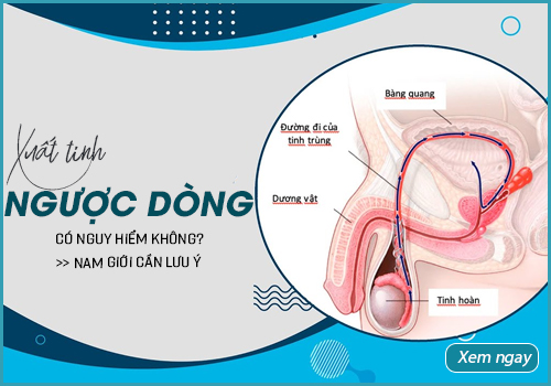 xuất tinh ngược dòng