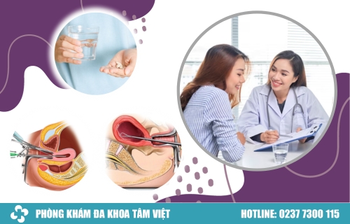 Các phương pháp phá thai an toàn và hiệu quả