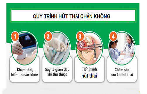 Quy trình thực hiện hút thai chân không